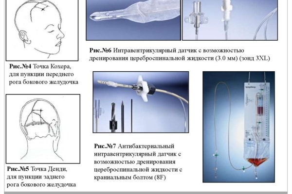 Как выйти на кракен